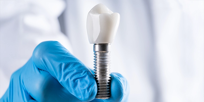 浜中デンタルクリニックが選ばれる「3つの強み」